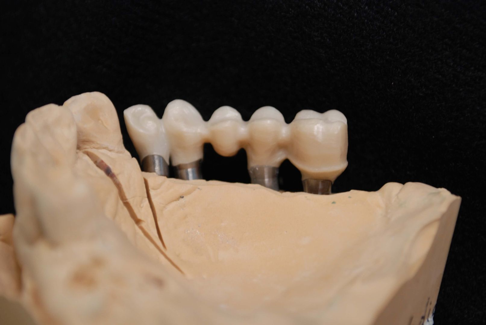 Implantat