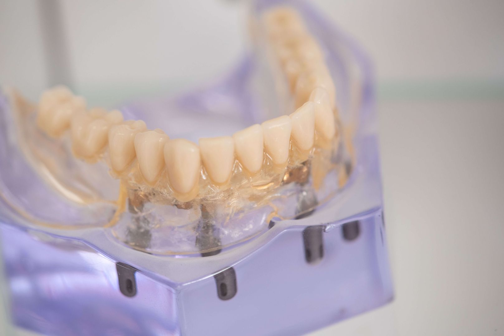 Implantat