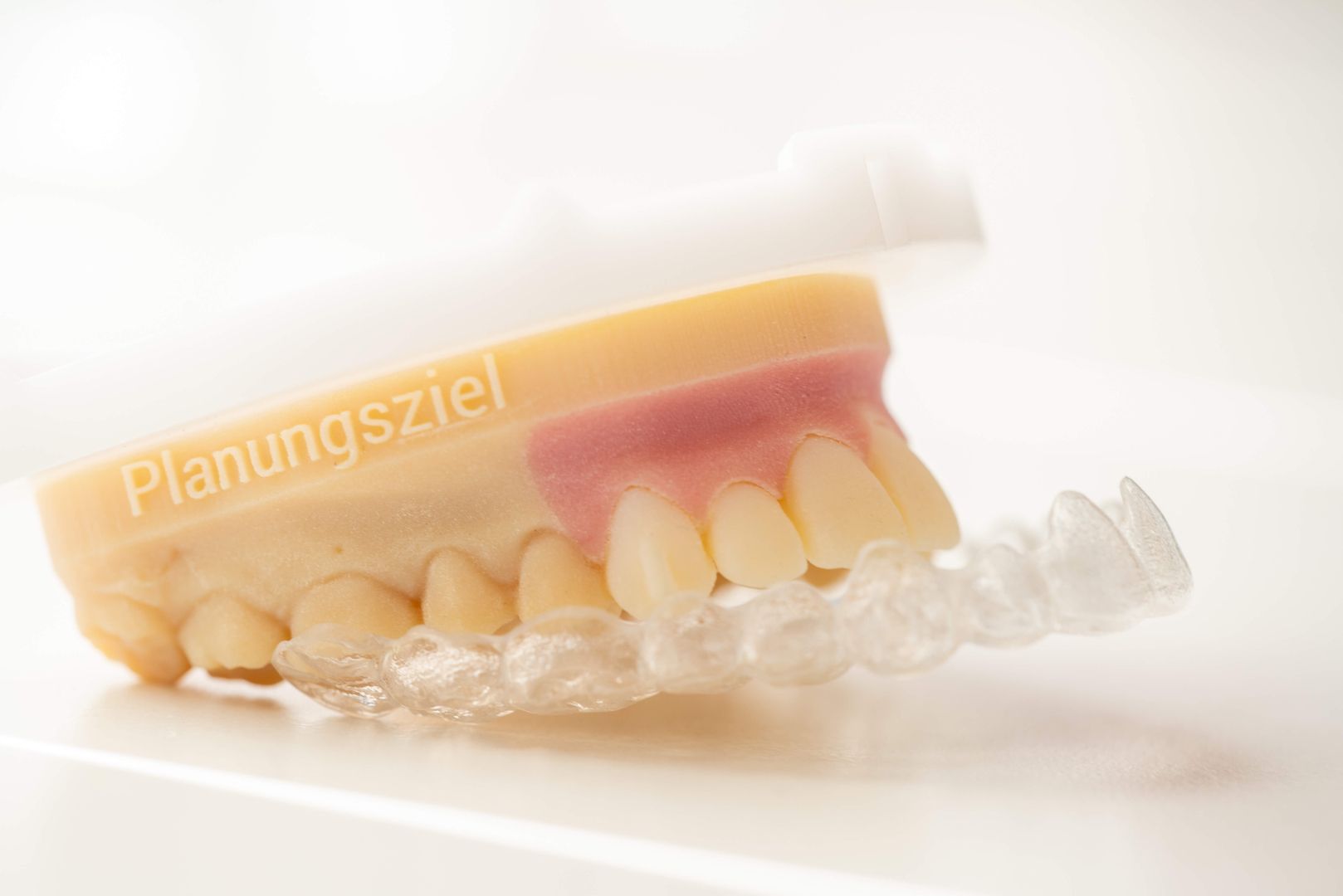 Aufbissschienen